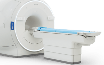 Cardiac MRI Scan